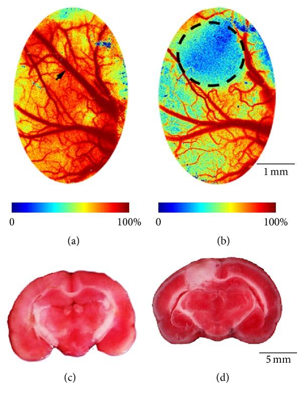 https://cdn.ncbi.nlm.nih.gov/pmc/blobs/32e7/4837289/e89159a21718/NP2016-1923160.002.jpg