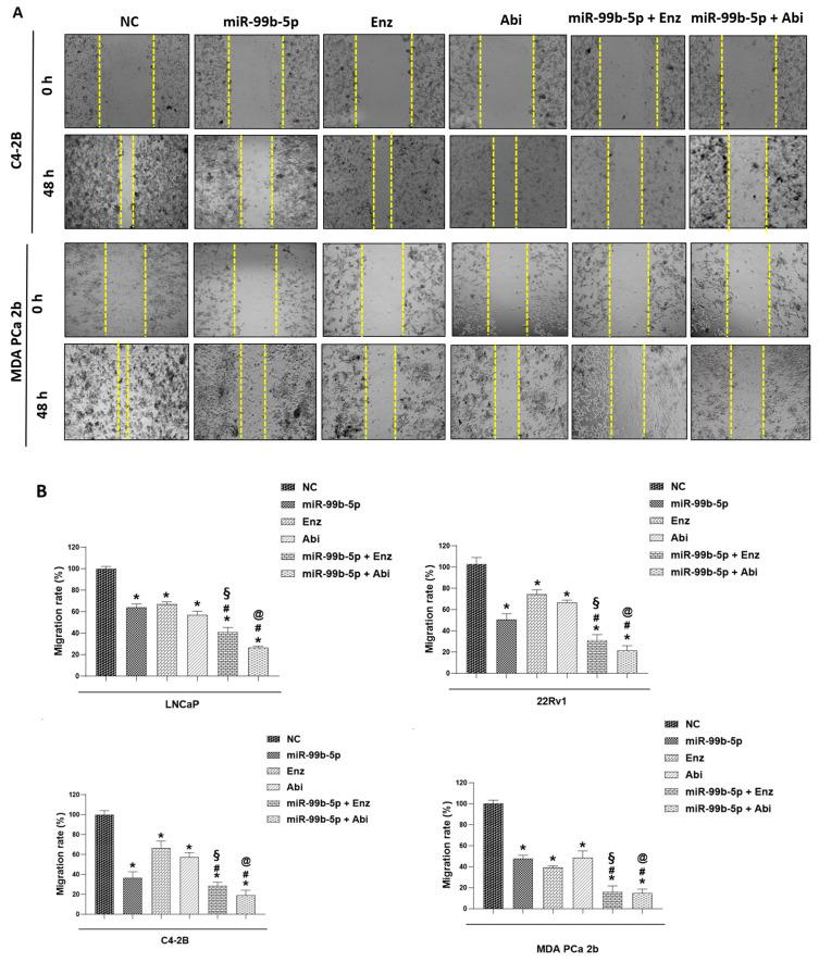 https://cdn.ncbi.nlm.nih.gov/pmc/blobs/32e8/11119738/aa68fdc12667/cancers-16-01933-g004.jpg