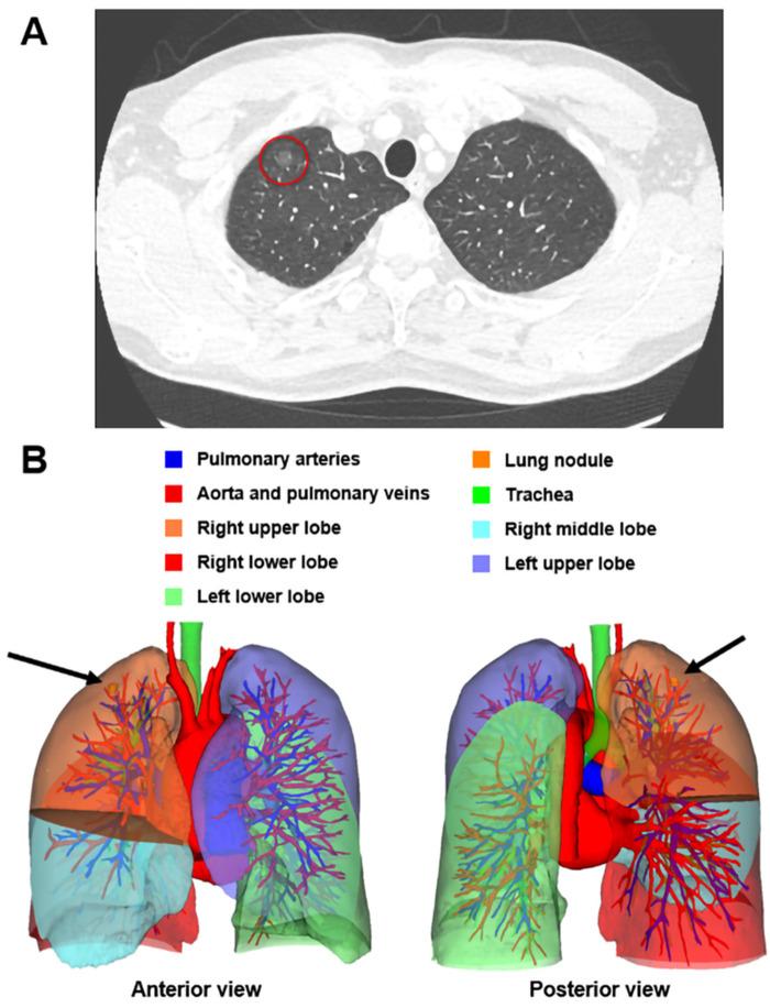 https://cdn.ncbi.nlm.nih.gov/pmc/blobs/32e8/9606583/d401114527ce/fsurg-09-941582-g001.jpg