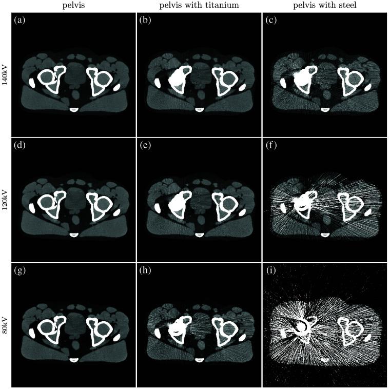 https://cdn.ncbi.nlm.nih.gov/pmc/blobs/32e9/10910563/3ff9bc52ee82/JMI-011-023501-g019.jpg