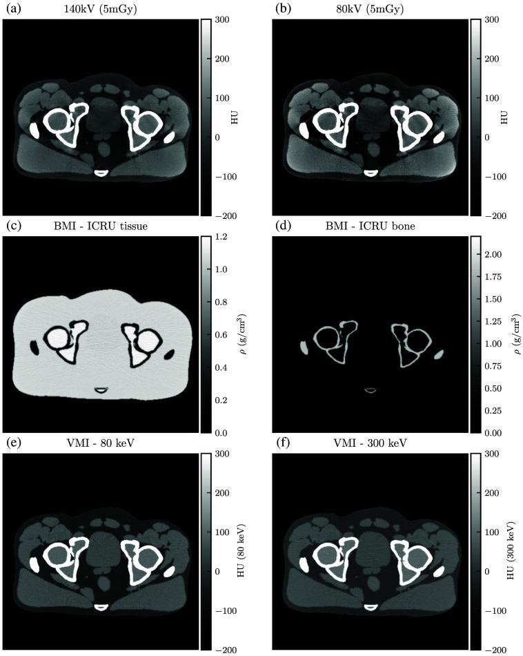 https://cdn.ncbi.nlm.nih.gov/pmc/blobs/32e9/10910563/8ef1aa75d37b/JMI-011-023501-g013.jpg