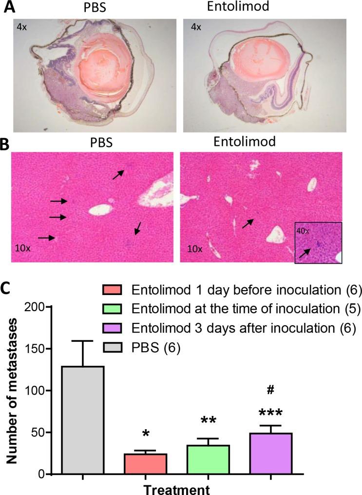 https://cdn.ncbi.nlm.nih.gov/pmc/blobs/32f1/4823082/0b4672d777fa/oncotarget-07-2936-g001.jpg