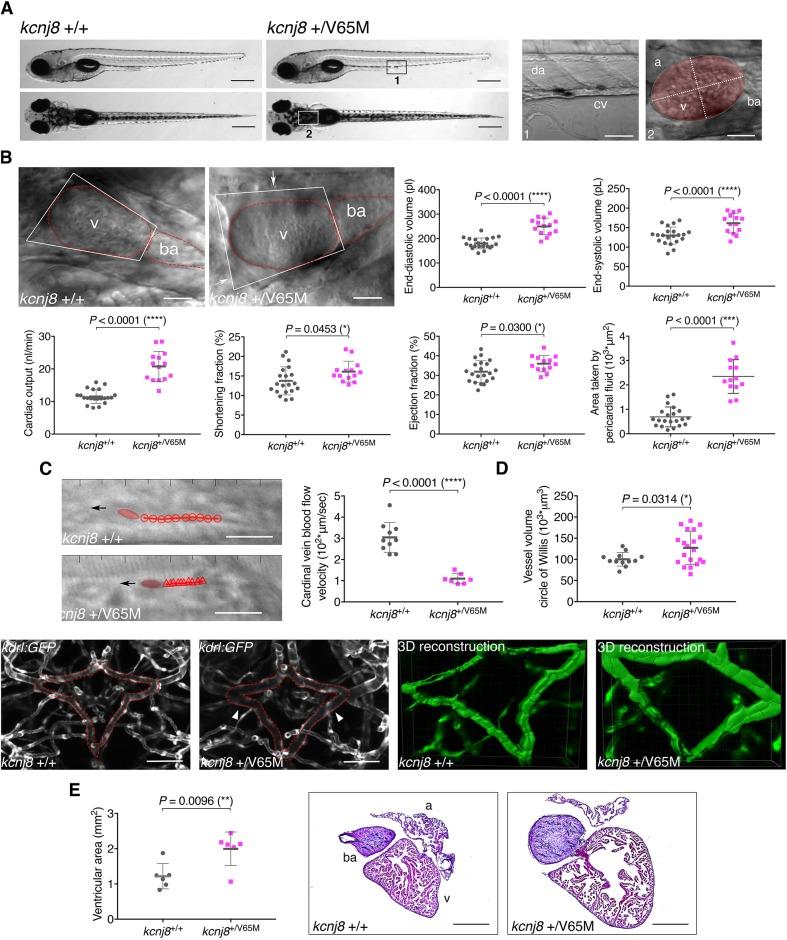 https://cdn.ncbi.nlm.nih.gov/pmc/blobs/32f1/6215435/3da07ac5731f/dmm-11-035469-g2.jpg