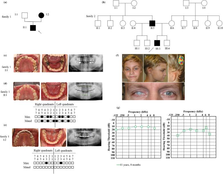 https://cdn.ncbi.nlm.nih.gov/pmc/blobs/32f2/10576343/a7b012e70785/40246_2023_539_Fig1_HTML.jpg