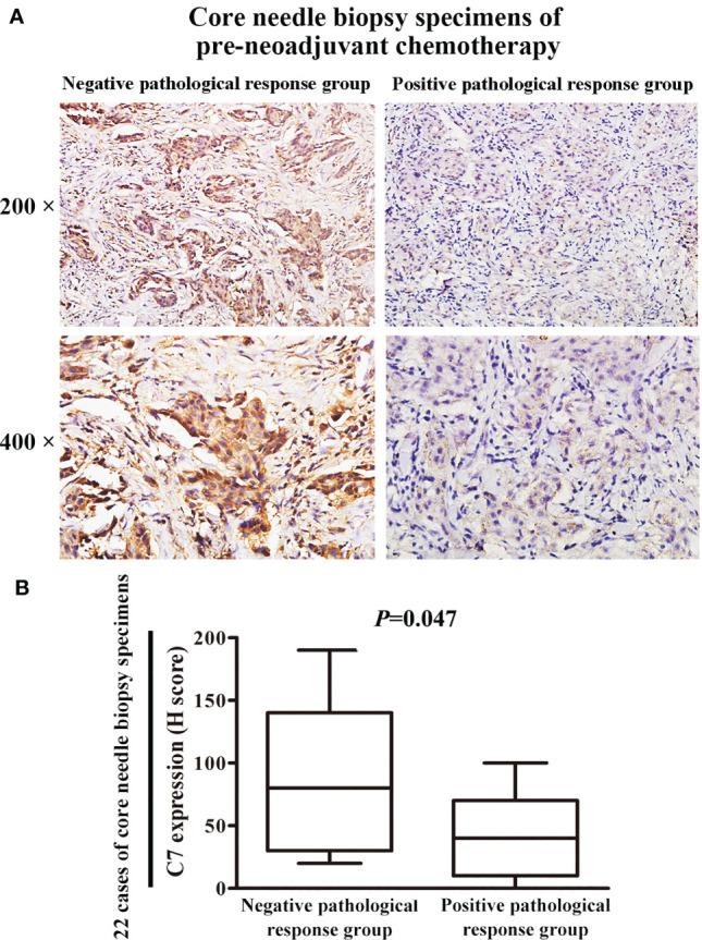 https://cdn.ncbi.nlm.nih.gov/pmc/blobs/32f7/8497743/155d7e44e2c9/fonc-11-724250-g009.jpg