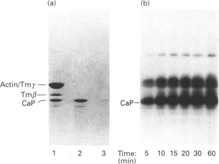 https://cdn.ncbi.nlm.nih.gov/pmc/blobs/32fc/1137769/97986bbfa46a/biochemj00097-0298-a.jpg