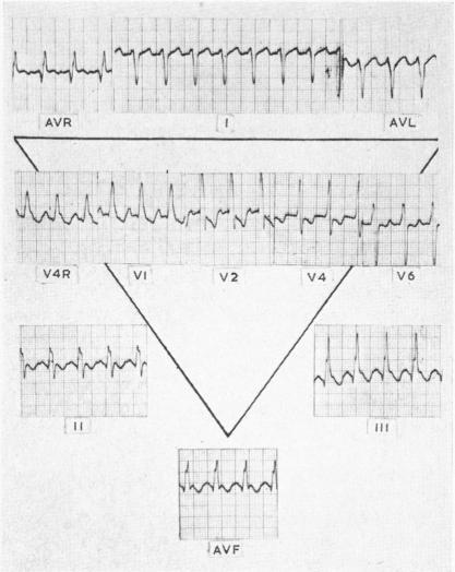 https://cdn.ncbi.nlm.nih.gov/pmc/blobs/32fc/2018877/213bf16dbdb6/archdisch01592-0091-b.jpg