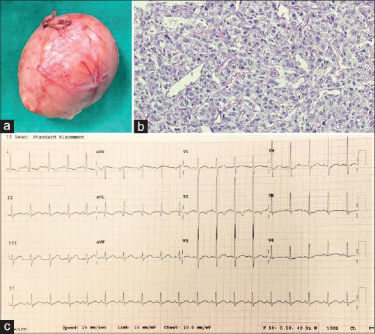 https://cdn.ncbi.nlm.nih.gov/pmc/blobs/3302/12063981/00144bdaded2/APC-17-455-g003.jpg
