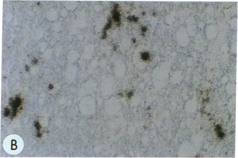 https://cdn.ncbi.nlm.nih.gov/pmc/blobs/3304/287127/0e573e2efdb7/pnas00249-0358-b.jpg