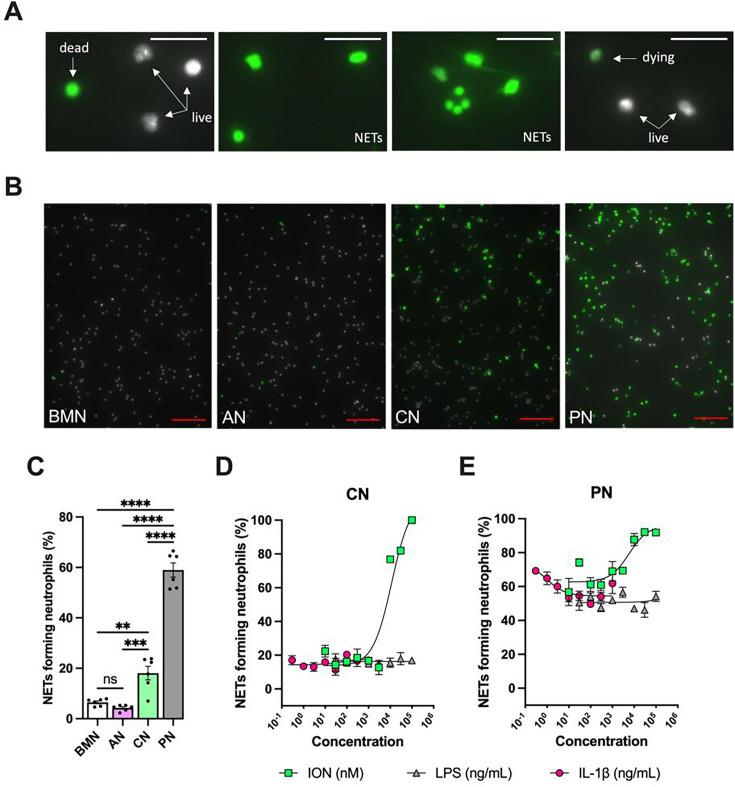 https://cdn.ncbi.nlm.nih.gov/pmc/blobs/3315/12187133/48a3aebafaec/elife-101990-fig4-figsupp2.jpg