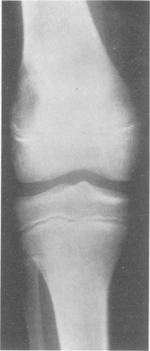 https://cdn.ncbi.nlm.nih.gov/pmc/blobs/3317/1344379/5fbfded94343/annsurg00271-0040-a.jpg