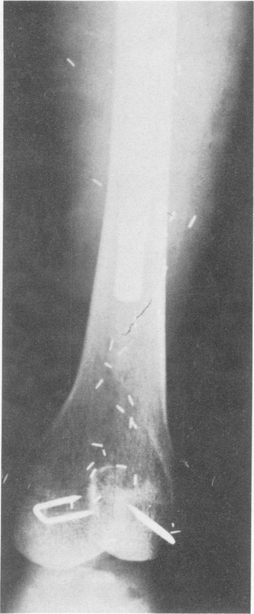 https://cdn.ncbi.nlm.nih.gov/pmc/blobs/3317/1344379/c757f231b4e4/annsurg00271-0042-a.jpg