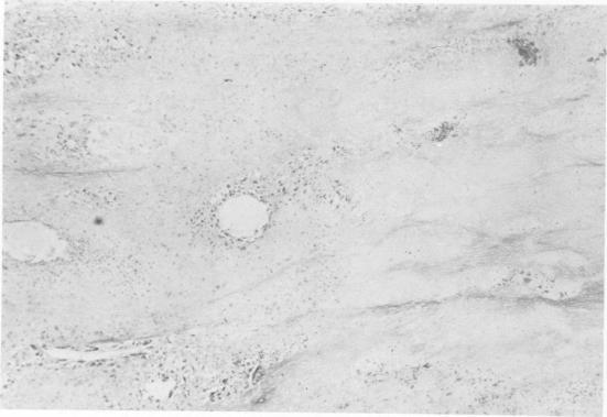 https://cdn.ncbi.nlm.nih.gov/pmc/blobs/3317/1344379/cce06992d686/annsurg00271-0041-b.jpg