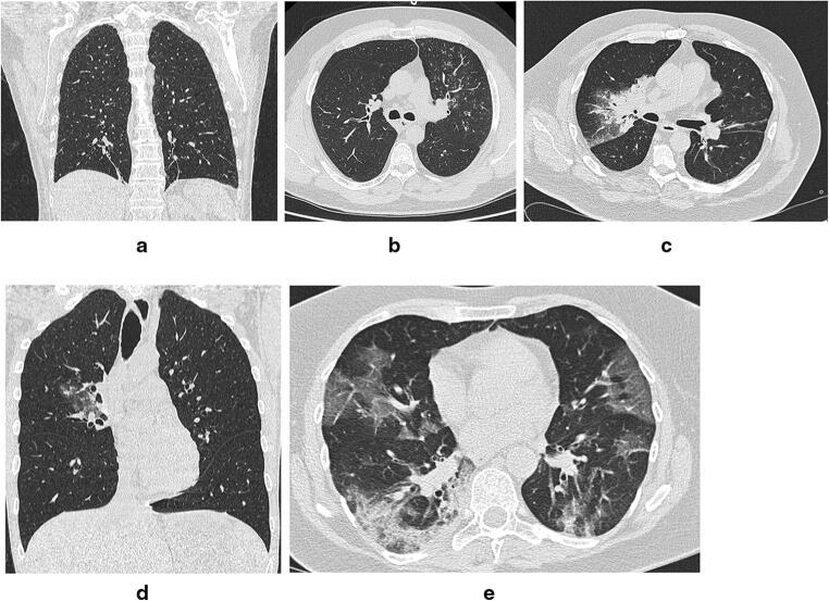 https://cdn.ncbi.nlm.nih.gov/pmc/blobs/3318/7369539/edf803df0e46/10140_2020_1821_Fig1_HTML.jpg