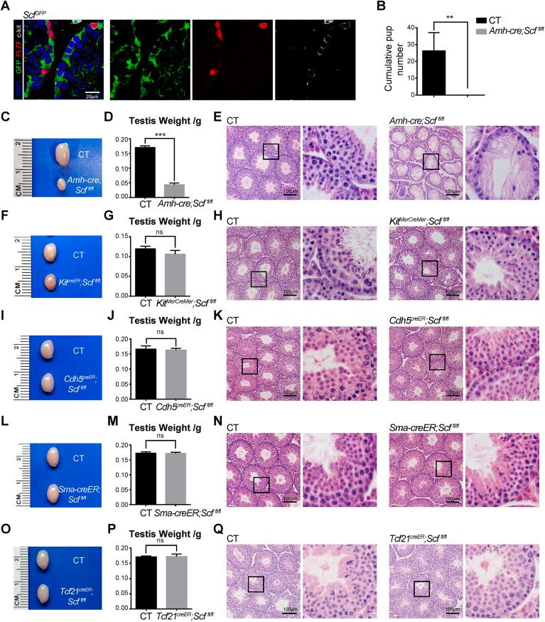 https://cdn.ncbi.nlm.nih.gov/pmc/blobs/331c/10112922/7349a795d764/develop-150-200706-g4.jpg