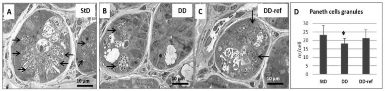 https://cdn.ncbi.nlm.nih.gov/pmc/blobs/3321/8066208/a528fbcec5f9/nutrients-13-01089-g007.jpg