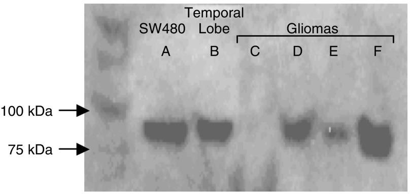 https://cdn.ncbi.nlm.nih.gov/pmc/blobs/3322/2361255/cf2d3080d4c3/94-6603006f3.jpg