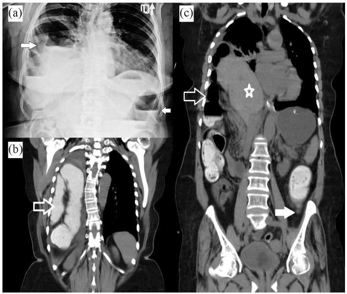 https://cdn.ncbi.nlm.nih.gov/pmc/blobs/3322/9926363/1c477c084401/10.1177_11795476231153283-fig1.jpg