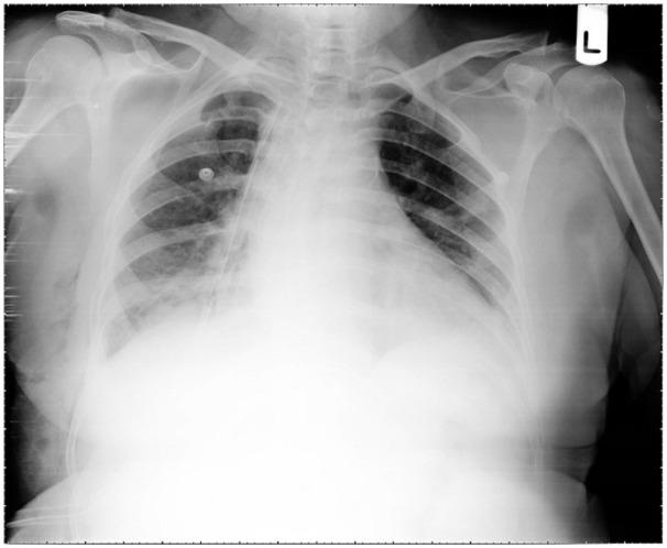 https://cdn.ncbi.nlm.nih.gov/pmc/blobs/3322/9926363/b50787f85bb5/10.1177_11795476231153283-fig2.jpg