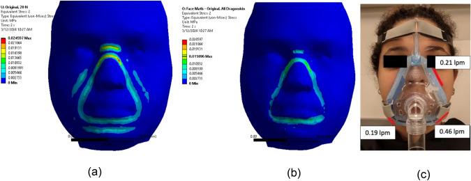 https://cdn.ncbi.nlm.nih.gov/pmc/blobs/3323/11560986/3bac36cfd1af/10439_2024_3581_Fig10_HTML.jpg