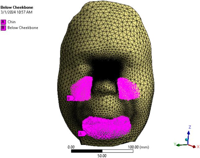 https://cdn.ncbi.nlm.nih.gov/pmc/blobs/3323/11560986/7794c500afb8/10439_2024_3581_Fig9_HTML.jpg