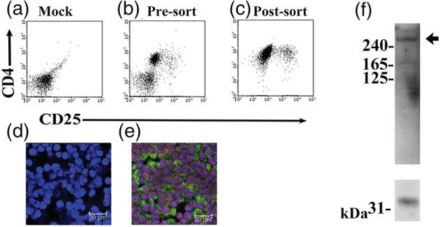 https://cdn.ncbi.nlm.nih.gov/pmc/blobs/3326/10344742/49972b547385/TCA-14-1941-g004.jpg