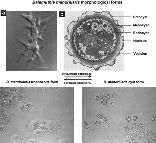 https://cdn.ncbi.nlm.nih.gov/pmc/blobs/3328/8579774/704a47810bea/TP-11-78-g001.jpg