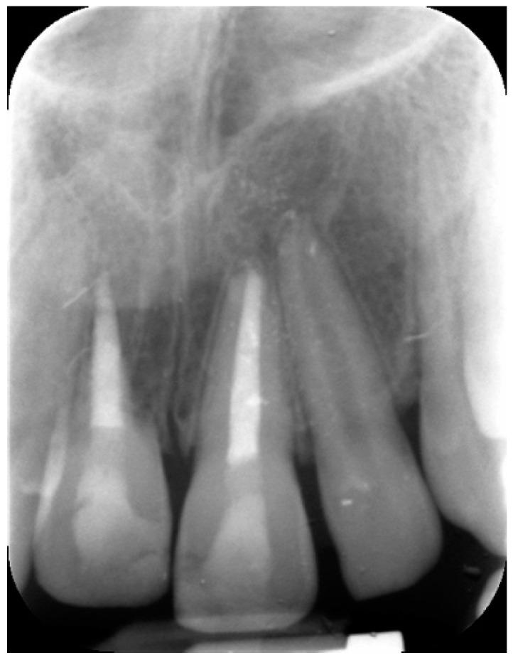 https://cdn.ncbi.nlm.nih.gov/pmc/blobs/332f/8233981/2fe9901c8684/dentistry-09-00072-g008.jpg