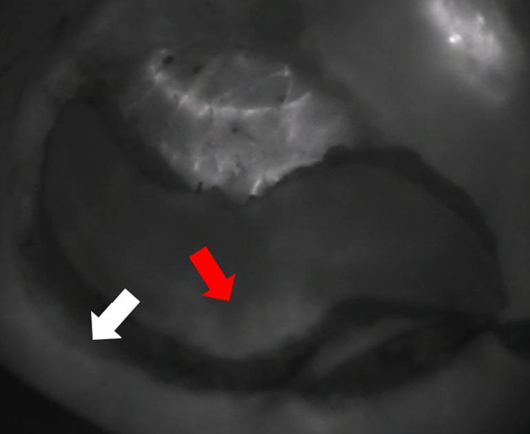 https://cdn.ncbi.nlm.nih.gov/pmc/blobs/3338/12322756/a4e0739cdcee/gs-14-07-1242-f3.jpg