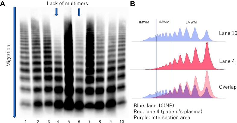 https://cdn.ncbi.nlm.nih.gov/pmc/blobs/3344/12356007/77fa44c8283f/gr3.jpg