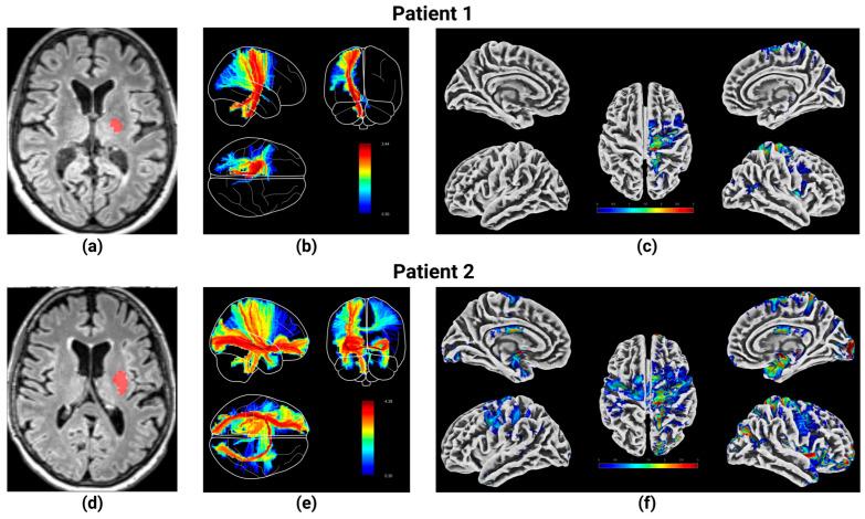 https://cdn.ncbi.nlm.nih.gov/pmc/blobs/3345/12293964/7e798757c643/brainsci-15-00735-g004.jpg