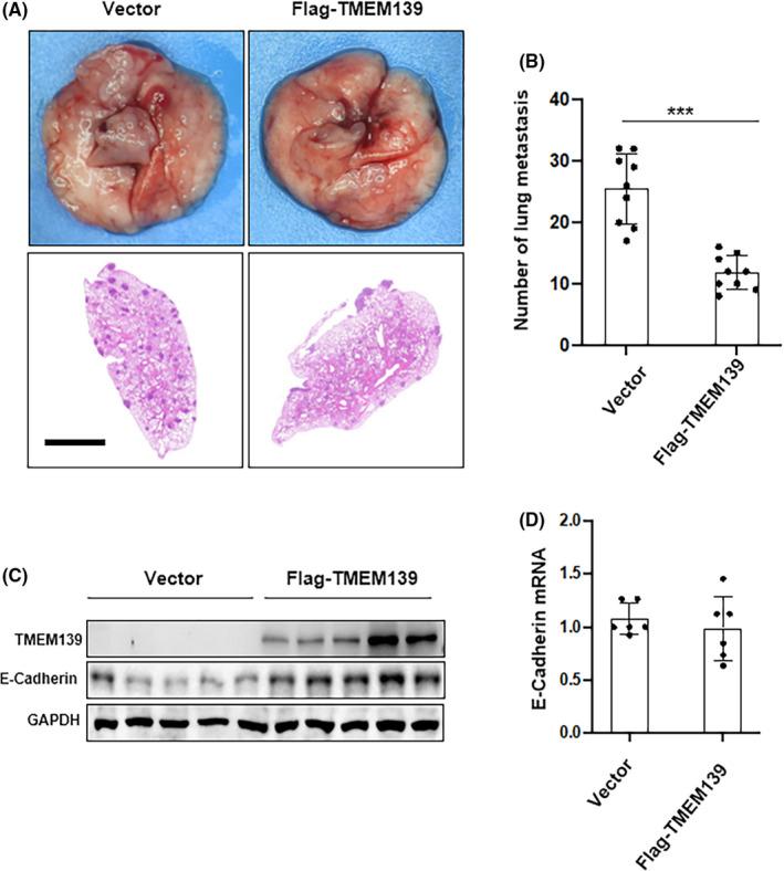 https://cdn.ncbi.nlm.nih.gov/pmc/blobs/3346/9207374/d6c10542337c/CAS-113-1999-g004.jpg