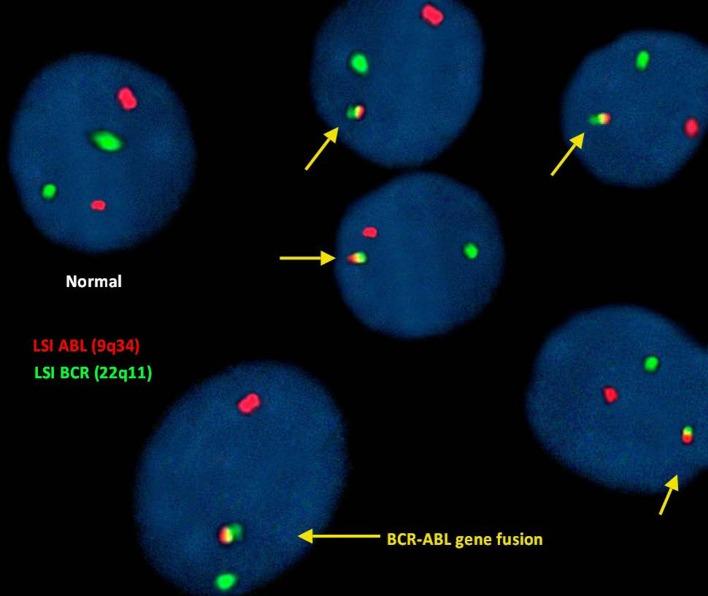 https://cdn.ncbi.nlm.nih.gov/pmc/blobs/334b/4885335/ea2e7c02590f/fonc-06-00124-g002.jpg