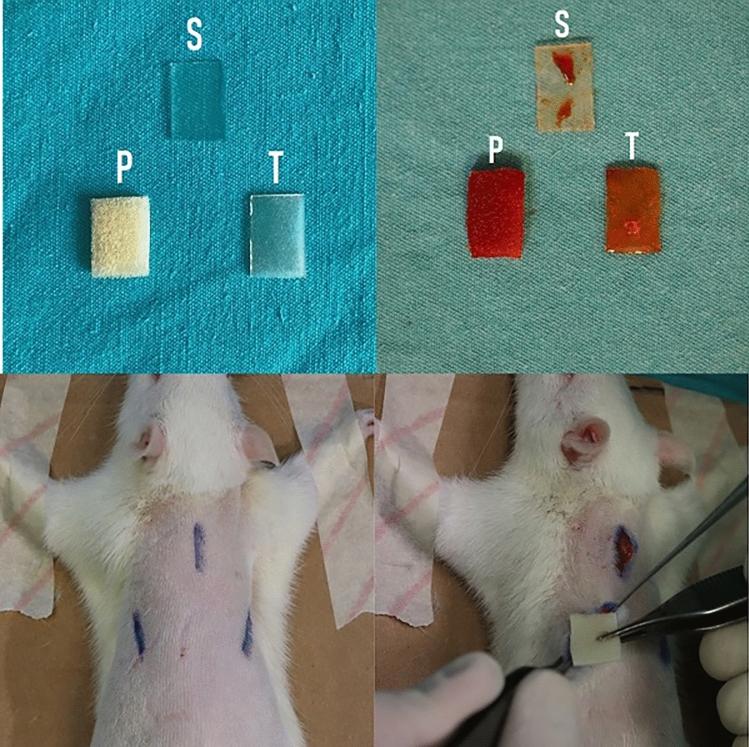 https://cdn.ncbi.nlm.nih.gov/pmc/blobs/3350/11739227/7f3323ba11d5/266_2024_4090_Fig1_HTML.jpg