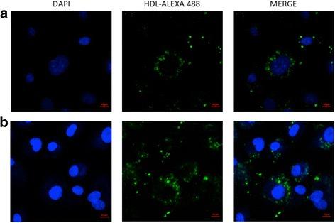 https://cdn.ncbi.nlm.nih.gov/pmc/blobs/3350/5845210/5017165e556c/12944_2018_695_Fig5_HTML.jpg