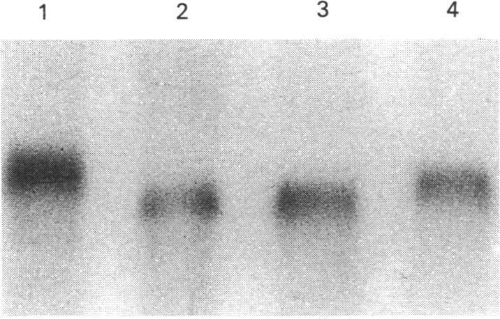 https://cdn.ncbi.nlm.nih.gov/pmc/blobs/3351/1135642/5ff1600d59f8/biochemj00214-0070-b.jpg