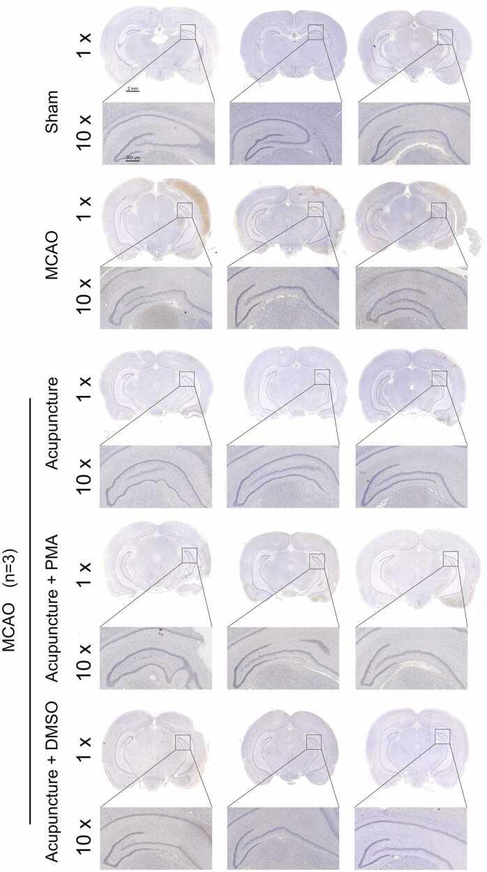 https://cdn.ncbi.nlm.nih.gov/pmc/blobs/3351/11919299/13b4125b9d6d/gr5.jpg