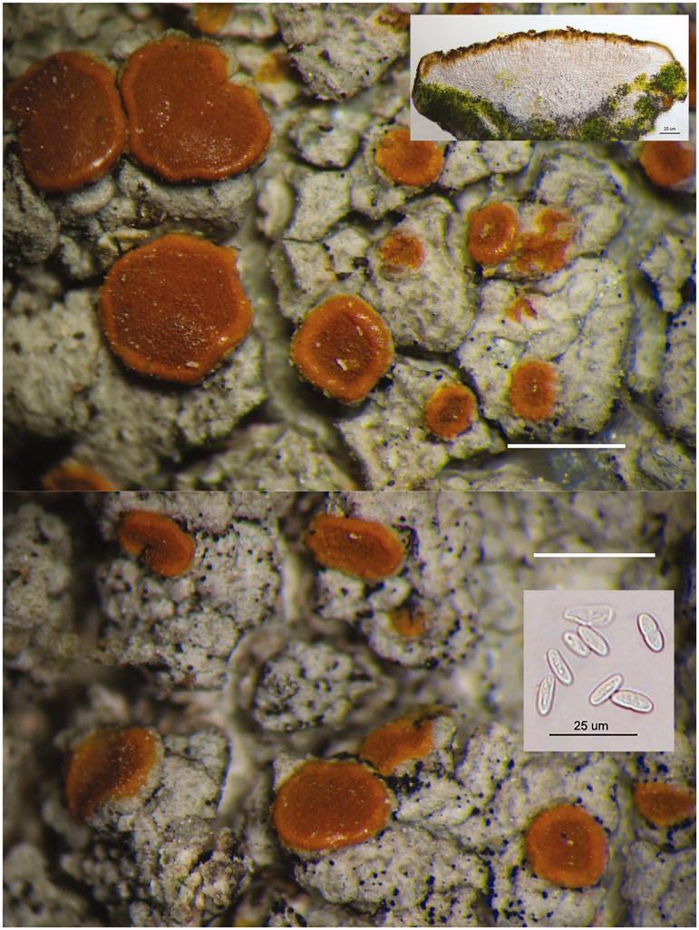 https://cdn.ncbi.nlm.nih.gov/pmc/blobs/3358/6968552/81fdf1507ae5/TMYB_A_1688074_F0003_C.jpg