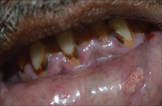 https://cdn.ncbi.nlm.nih.gov/pmc/blobs/3364/4886590/6bbf453db389/IDOJ-7-180-g001.jpg