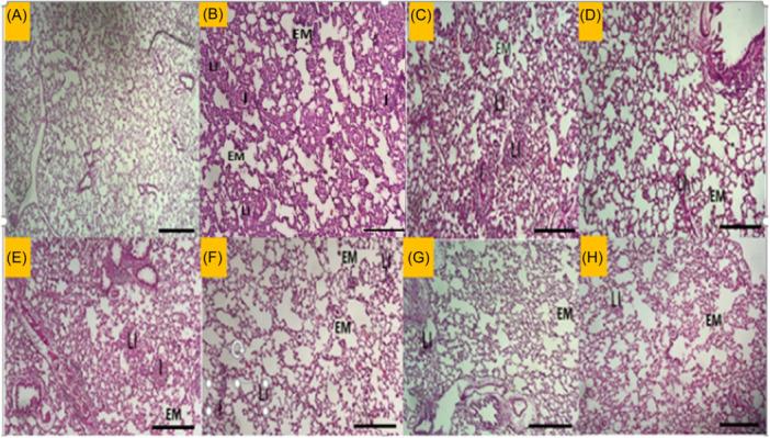 https://cdn.ncbi.nlm.nih.gov/pmc/blobs/3367/11340013/99f255e8b0ca/IID3-12-e70001-g009.jpg