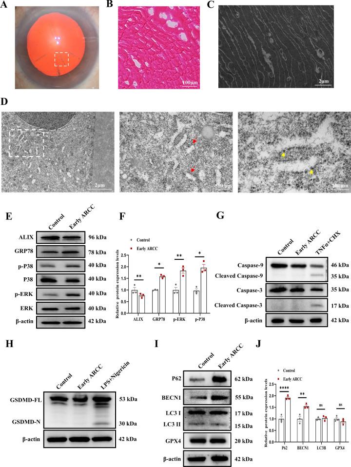 https://cdn.ncbi.nlm.nih.gov/pmc/blobs/3367/11734758/a886665ba97f/iovs-66-1-29-f001.jpg