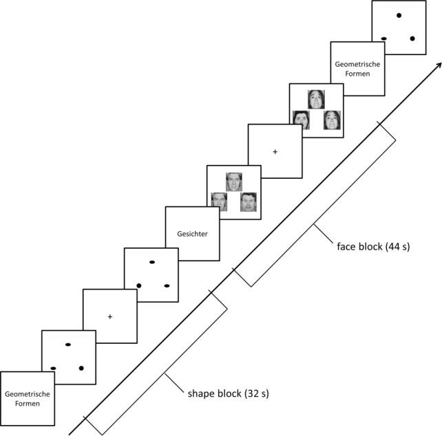 https://cdn.ncbi.nlm.nih.gov/pmc/blobs/336b/8595454/aa1ec8baa0b9/40345_2021_240_Fig3_HTML.jpg