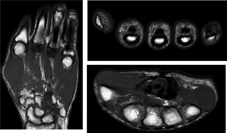 https://cdn.ncbi.nlm.nih.gov/pmc/blobs/3377/10264839/6a8636a39aac/gr2.jpg