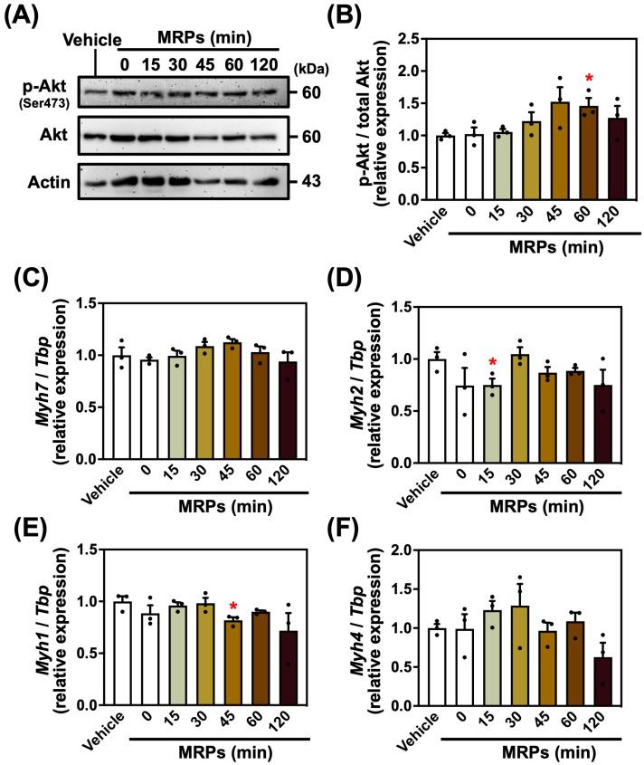 https://cdn.ncbi.nlm.nih.gov/pmc/blobs/3377/12113465/2ff24b4e0d65/metabolites-15-00316-g003.jpg