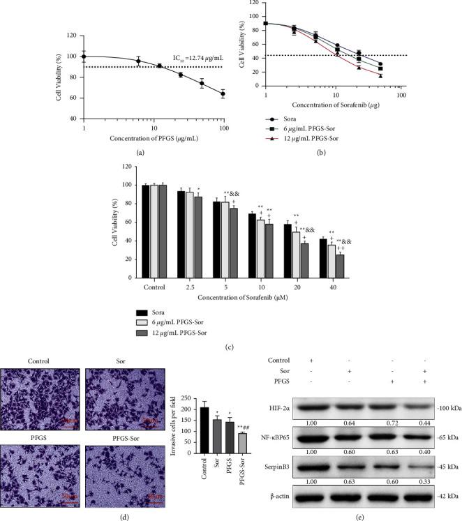 https://cdn.ncbi.nlm.nih.gov/pmc/blobs/3378/9588328/c802cc5fce32/ECAM2022-1911311.005.jpg
