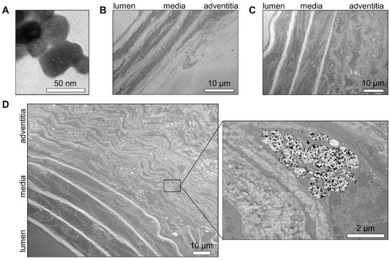 https://cdn.ncbi.nlm.nih.gov/pmc/blobs/337a/8058712/58223043154b/thnov11p5876g005.jpg