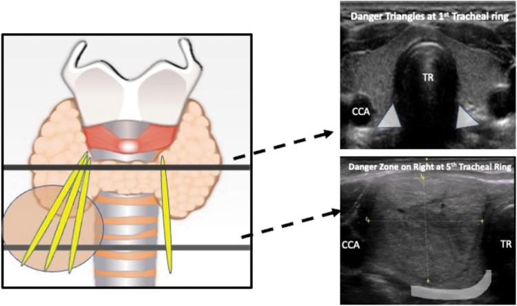 https://cdn.ncbi.nlm.nih.gov/pmc/blobs/337e/10611977/be585c7c2654/thy.2023.0281_figure2.jpg