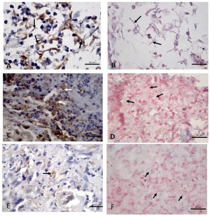 https://cdn.ncbi.nlm.nih.gov/pmc/blobs/3380/9695648/771775a2f563/tropicalmed-07-00344-g002.jpg