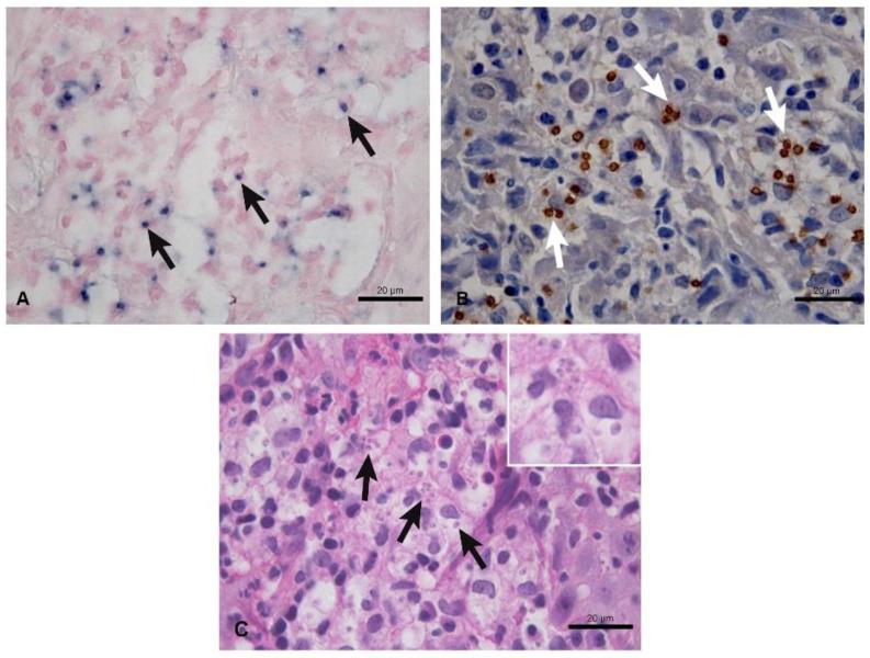 https://cdn.ncbi.nlm.nih.gov/pmc/blobs/3380/9695648/ba3dff89aa74/tropicalmed-07-00344-g001.jpg
