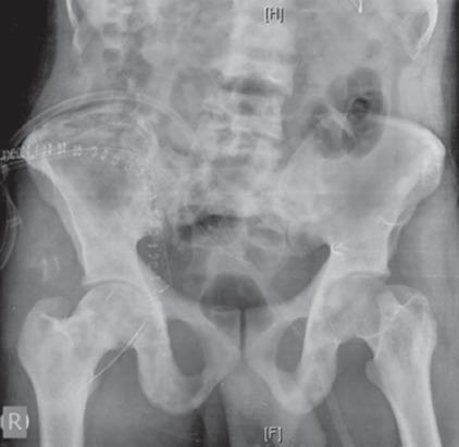 https://cdn.ncbi.nlm.nih.gov/pmc/blobs/3381/5288610/7d5170edc252/JOCR-6-103-g009.jpg
